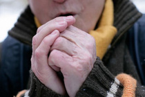 Холодовая травма!